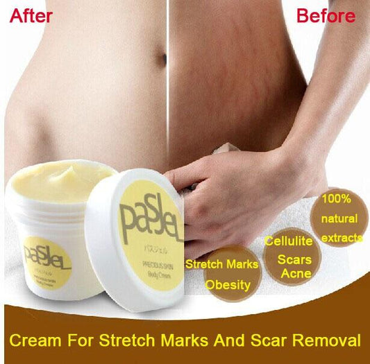 Pasjel Repair Cream -  PREGNANCY STRETCH MARK REMOVAL & ANTI AGING CREAM