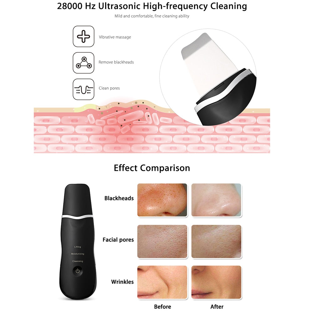 Ultrasonic Skin Scrubber