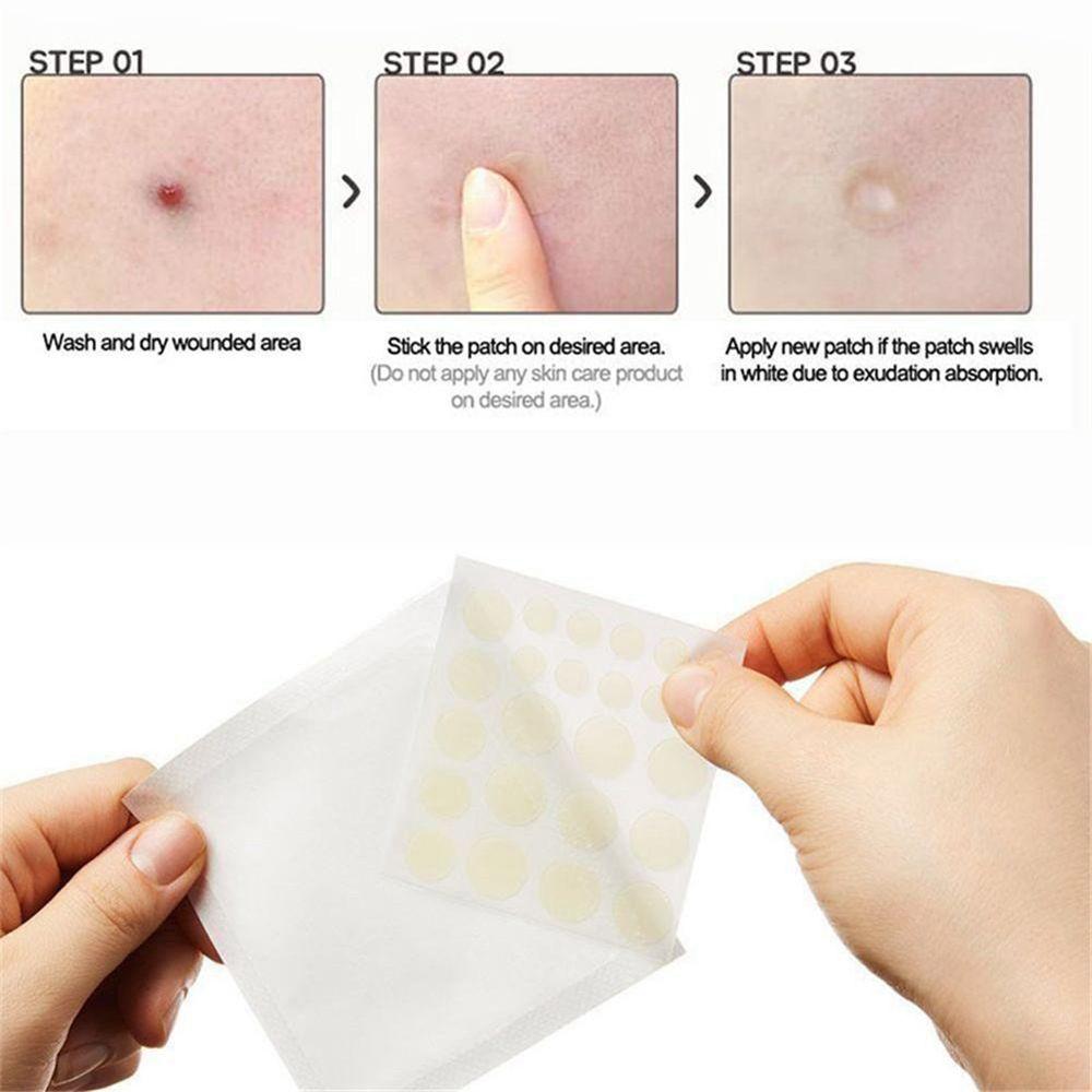 Beauty Acne Patch Set (24 PCS)